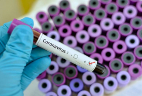 Almaniyada 9914 nəfər koronavirusdan ölüb
